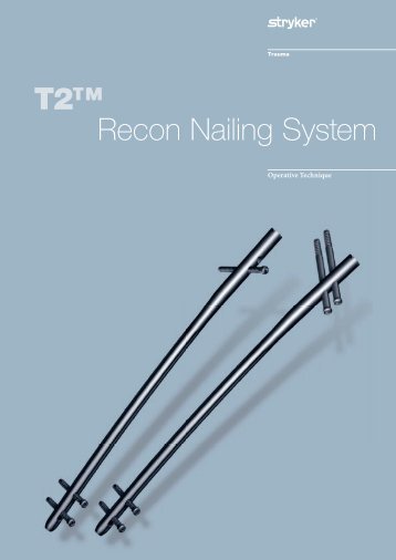 T2™ Recon Nailing System - Percivall Pott Rotation