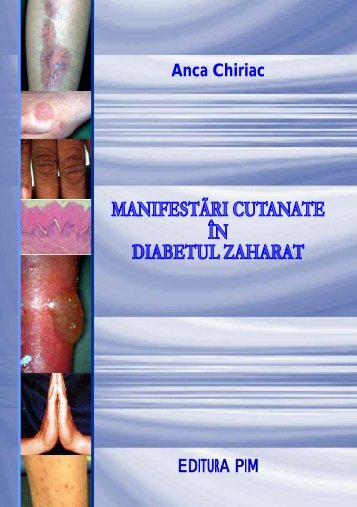 Manifestari cutanate in diabetul zaharat - PIM Copy