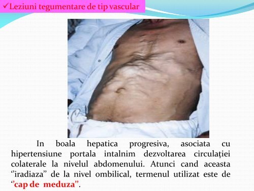 MANIFESTARI DERMATOLOGICE IN BOLILE HEPATICE.pdf