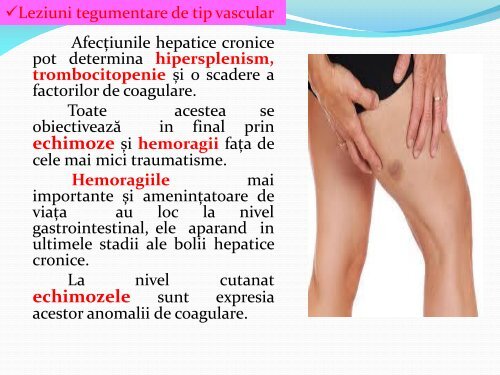 MANIFESTARI DERMATOLOGICE IN BOLILE HEPATICE.pdf