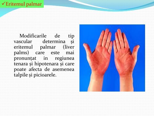 MANIFESTARI DERMATOLOGICE IN BOLILE HEPATICE.pdf