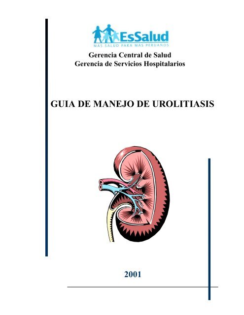GUIA DE MANEJO DE UROLITIASIS - EsSalud