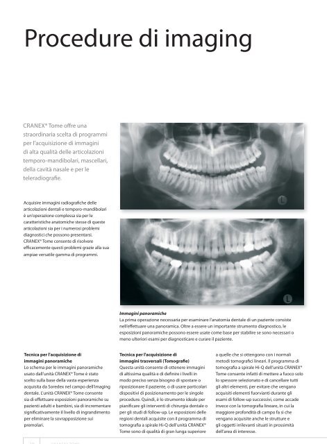 scarica la brochure - Radiologia Italia Srl