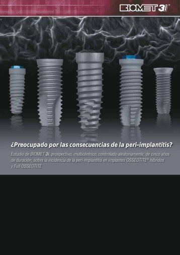 ¿Preocupado por las consecuencias de la peri-implantitis?