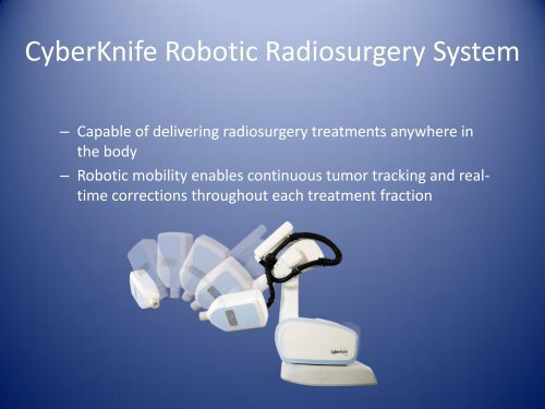 Cyberknife SBRS for the treatment of Pancreatic Cancer