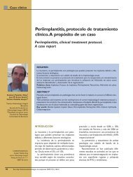 Periimplantitis, protocolo de tratamiento clínico. A propósito de un ...
