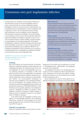 Consensus over peri-implantaire infecties