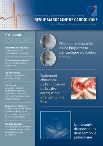 Revue N° 17 - Société Marocaine de Cardiologie