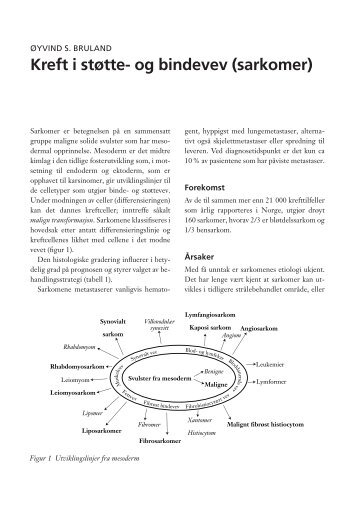 Kreft i støtte- og bindevev (sarkomer) - Professor Øyvind S. Bruland
