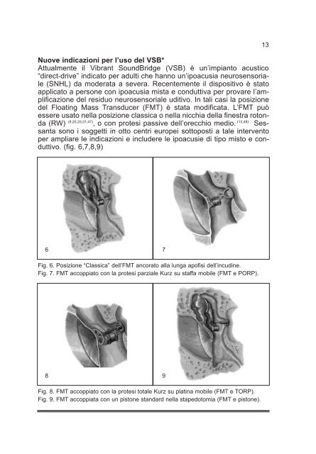 Tiroidectomia Totale: How I do it - AOOI