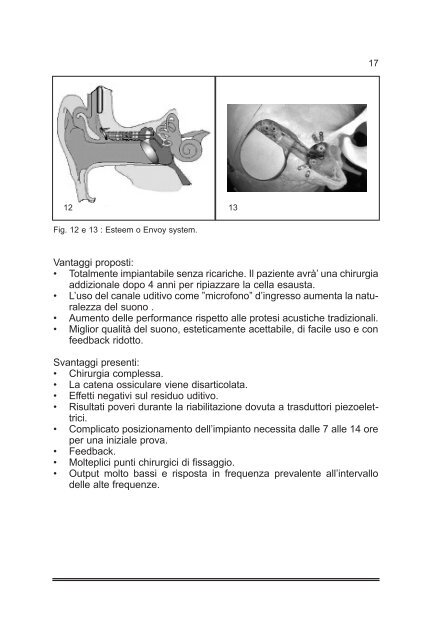 Tiroidectomia Totale: How I do it - AOOI
