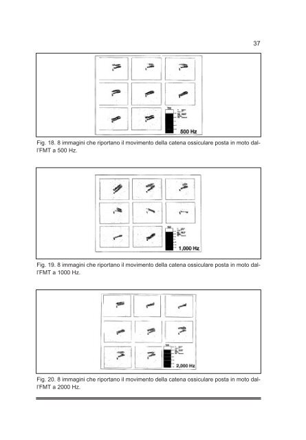 Tiroidectomia Totale: How I do it - AOOI