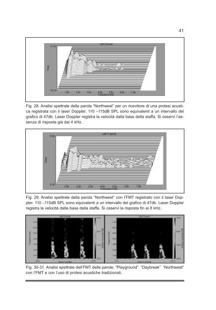 Tiroidectomia Totale: How I do it - AOOI