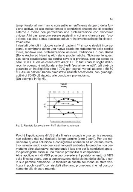 Tiroidectomia Totale: How I do it - AOOI