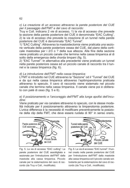 Tiroidectomia Totale: How I do it - AOOI