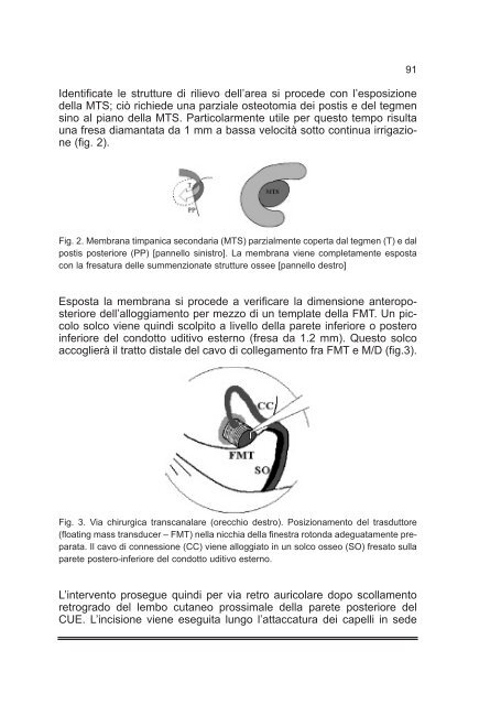 Tiroidectomia Totale: How I do it - AOOI