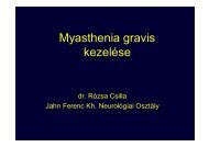 Myasthenia gravis kezelése