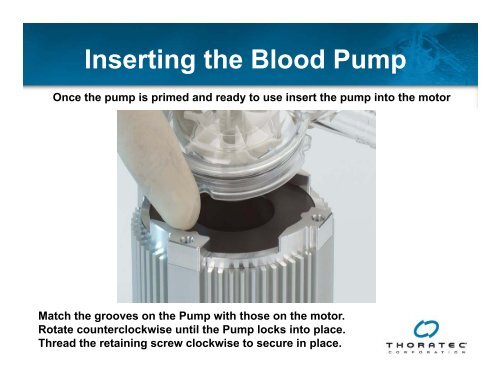 View CentriMag Magnetically Levitated Circulatory Support System