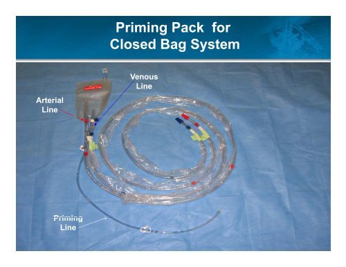 View CentriMag Magnetically Levitated Circulatory Support System