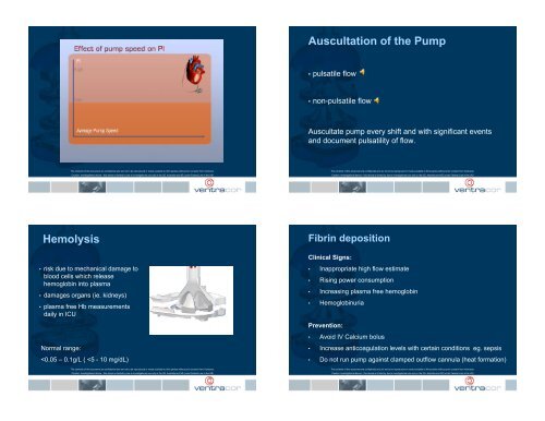 LVAD types - aldmd