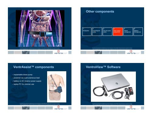 LVAD types - aldmd