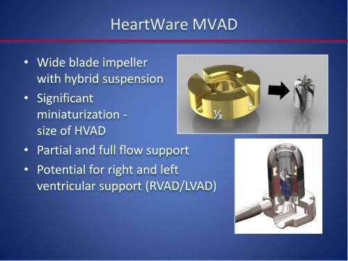 Emerging LVAD Technology for the Use - Washington Hospital Center