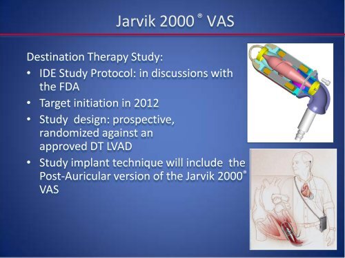 Emerging LVAD Technology for the Use - Washington Hospital Center