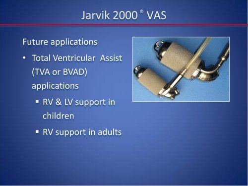 Emerging LVAD Technology for the Use - Washington Hospital Center