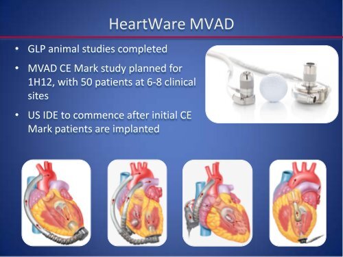 Emerging LVAD Technology for the Use - Washington Hospital Center