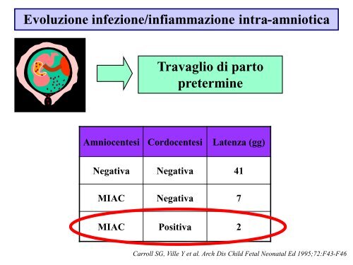 PPROM Eziopatogenesi, fattori di rischio e possibilità di predizione