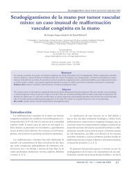 Seudogigantismo de la mano por tumor vascular mixto - Sociedad ...