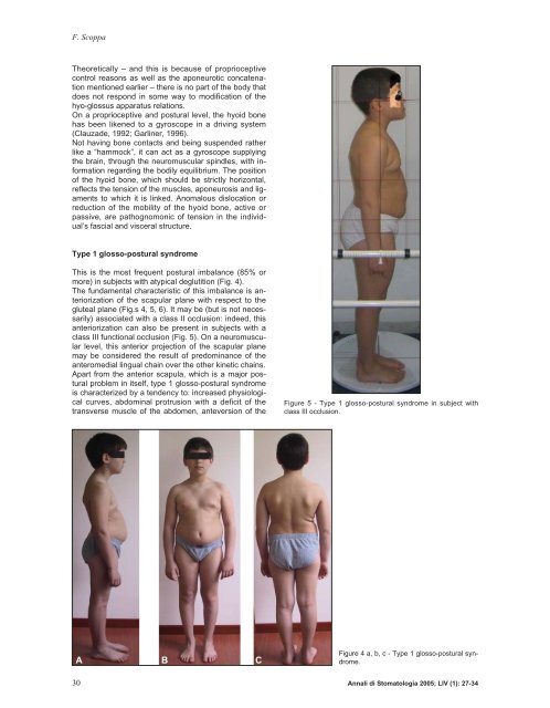 Glosso-postural syndrome
