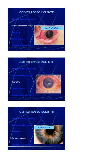 L'Occhio Rosso - Clinica Oculistica Universitaria di Pisa