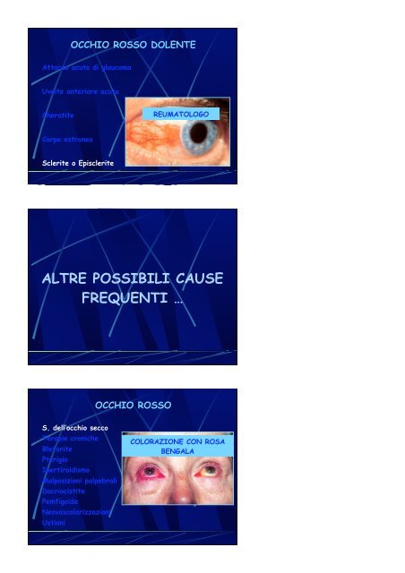 L'Occhio Rosso - Clinica Oculistica Universitaria di Pisa