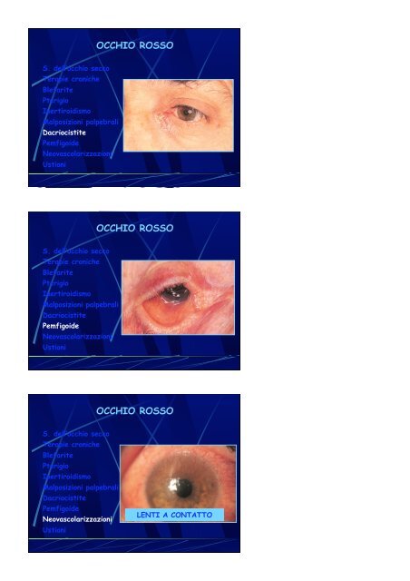 L'Occhio Rosso - Clinica Oculistica Universitaria di Pisa