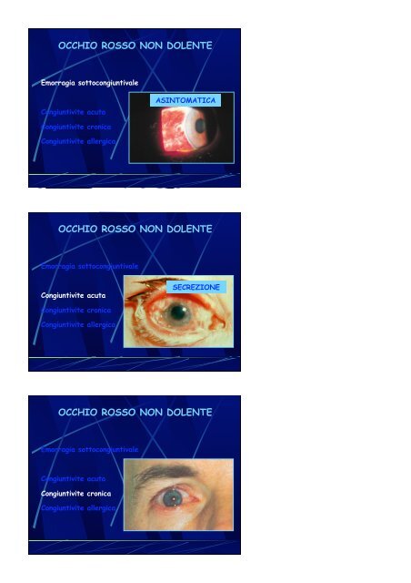 L'Occhio Rosso - Clinica Oculistica Universitaria di Pisa