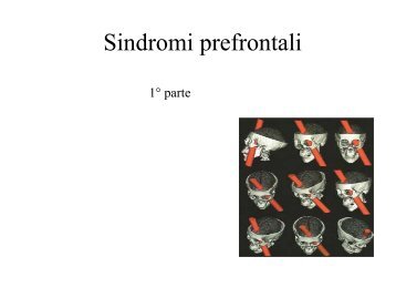 Sindrome prefrontale dorsolaterale (tipo ... - SognoPsicologia