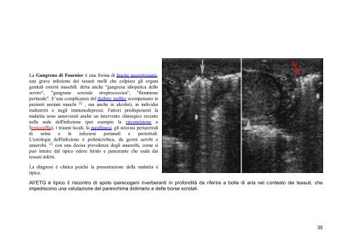 Imaging del contenuto scrotale - Vincenzoalessiradiologia.It