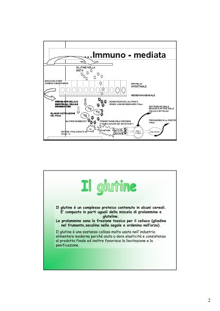 Intolleranza permanente al glutine Enteropatia immuno ... - DoRS