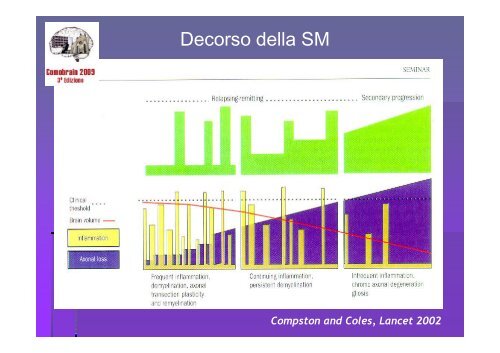 SCLEROSI MULTIPLA E MALATTIE AUTOIMMUNI - Comobrain