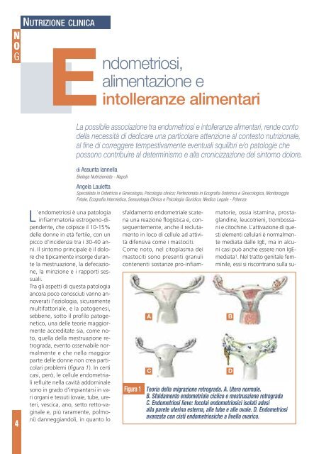 programma di dieta per l intolleranza al grano