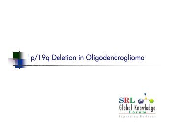 1p/19q Deletion in Oligodendroglioma - Srl