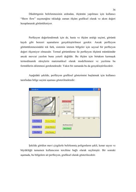 koroner arter cerrahisinde termal görüntüleme kullanılarak greft ...