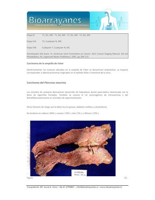 Patología de las Neoplasias del Tubo Digestivo. - Bioarrayanes