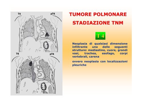 La diagnostica per immagini del polmone e della pleura