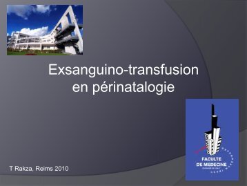 fmc01-2-exsanguino-transfusion-perinatale-rakza - Société ...