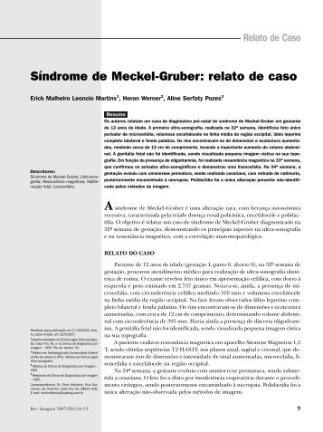 síndrome de meckel.pmd - SPR