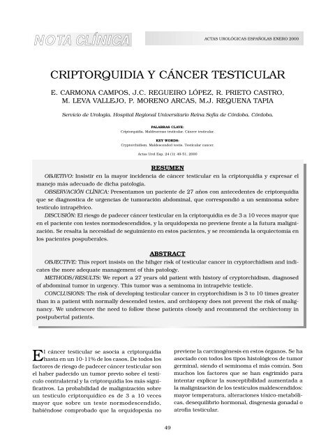 Perdida de peso dolor abdominal testicular cancer