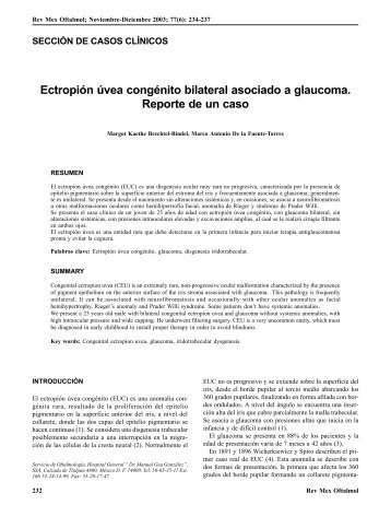 Ectropión úvea congénito bilateral asociado a glaucoma. Reporte ...