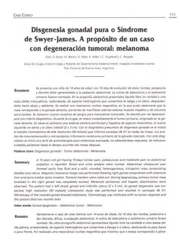 Disgenesia gonadal pura o Síndrome de Swyer-James. A ... - ACACI